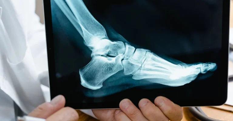 Ankle Injury At Work